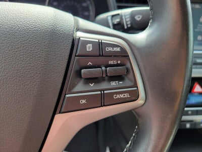 2017 Hyundai Elantra Value Edition
